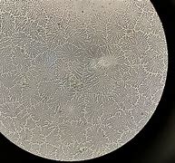 Image result for Happy vs Sad Tears Under a Microscope