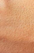 Image result for Macro Skin Pores