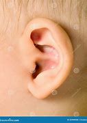 Image result for Ear of Boy