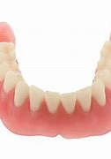 Image result for Bottom Dentures