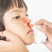 Image result for Aesthetic Nose Bleed