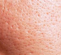 Image result for Macro Skin Pores