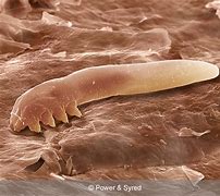 Image result for Mites On EyeLashes