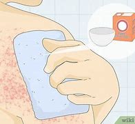 Image result for Soap for Heat Rash