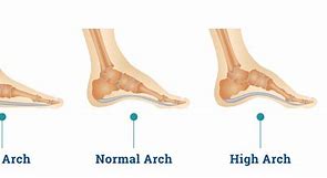 Image result for Three Arches of the Foot