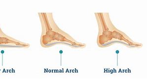 Image result for 3 Arches of the Foot