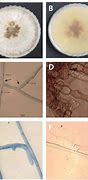 Image result for Rhizoctonia Solani