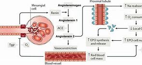 Image result for Pheochromocytoma Renin