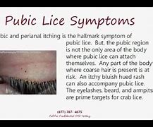 Image result for Crabs Skin Disease