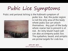 Image result for Crabs Infection