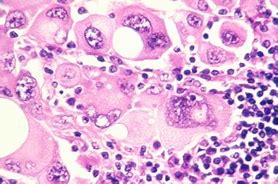 Image result for Pathology Images