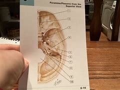 Image result for Body Foramen