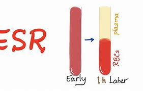 Image result for ESR Stand for Lab