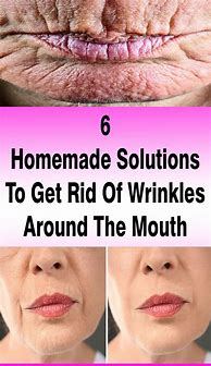 Image result for How to Remove Wrinkles around Mouth