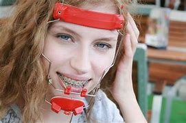 Image result for Full Orthodontic Headgear