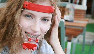 Image result for Orthodontic Headgear