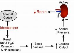 Image result for Pheochromocytoma Renin