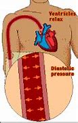 Image result for Blood Pressure Monitor GIF