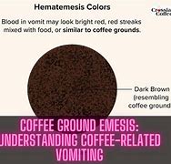 Image result for Coffee Ground Hematemesis