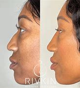 Image result for African American Nose vs African Nose