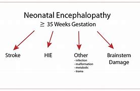 Image result for Pediatric Encephalopathy