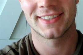 Image result for Dimples Near Chin