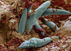 Image result for Face Mites On Human Back