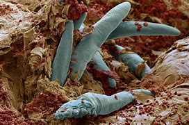 Image result for Mites That Live On Your Face