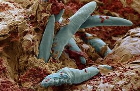 Image result for Itch Mites On Face