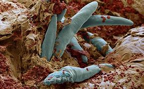 Image result for Mites On Face Skin Infection