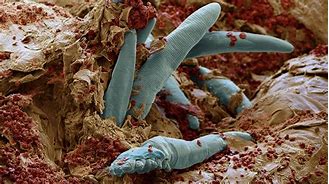 Image result for Face Mites Up Close