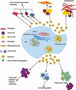 Image result for Exosome Tumor