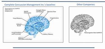 Image result for Concussion Anatomy