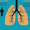 Image result for Chronic Emphysema