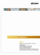 Image result for Orbital Floor Plate Stryker