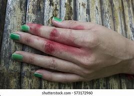 Image result for Women Hands Bleeds