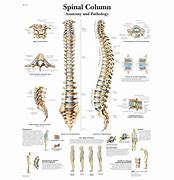 Image result for Spinal DIC Chart