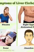 Image result for Early Symptoms Cirrhosis Liver