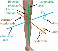 Image result for Lateral Knee Pain with Internal Rotation