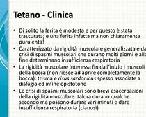 Image result for Tetano Muscolare