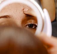 Image result for Ingrown Hair Pimple