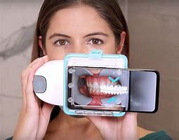 Image result for 3D Teeth Scanner