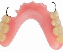 Image result for partial denture clasps materials