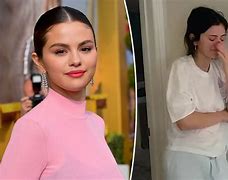 Image result for Selena Gomez Now Lupus