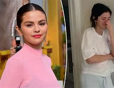 Image result for Selena Gomez with Lupus