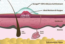 Image result for Xeragel Gel