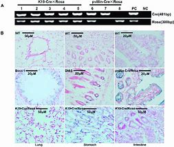 Image result for Z CRE Gene