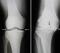 Image result for Normal Knee Skin