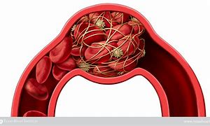 Image result for Blood Clotting