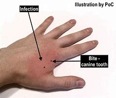 Image result for Cat Bite Face